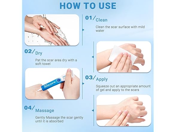 Kunyle BC521525090026 silicone scar gel