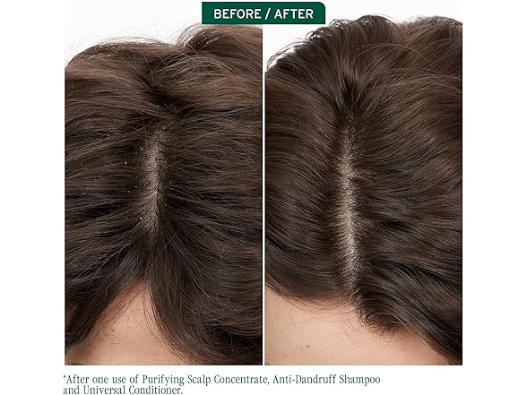 Biolage Scalp Sync Anti-Dandruff Shampoo