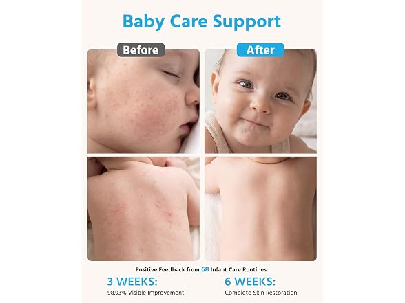 Syvahome Pro Baby Bath Tub Water Filter