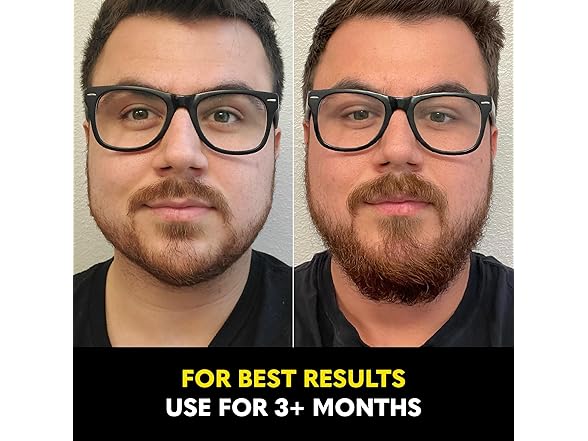 Beard Club - Beard Growth Serum