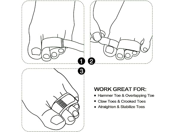 Reppkyh 20 Pieces Fabric Broken Toe Wrap