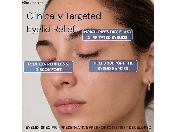 BlinkBetter BetterLids Eyelid Ointment Dry Itchy