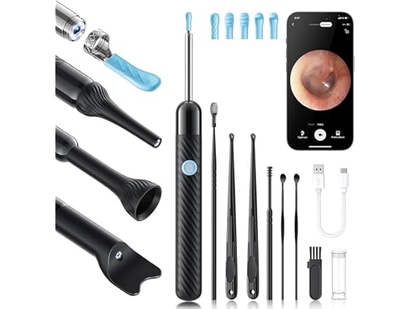 Loyker Ear Wax Removal Kit