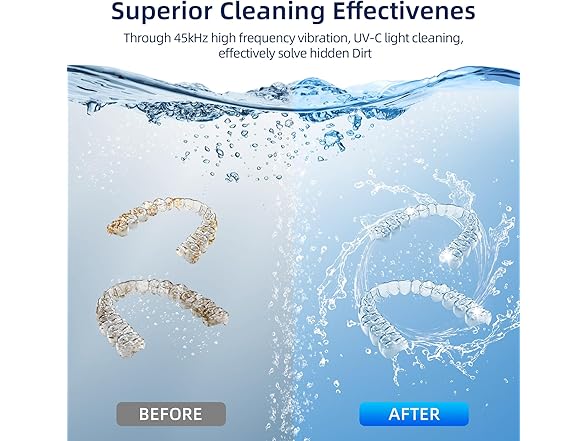 EcoBasic Ultrasonic Retainer Cleaner Machine
