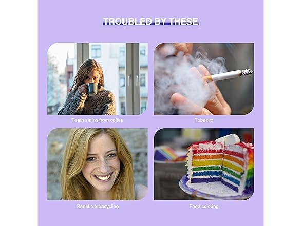 LUXSMILE Teeth Whitening Kit