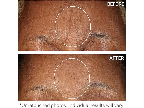 triVectin Anti-Wrinkle SD Moisturizing Concentrate: Your Choice