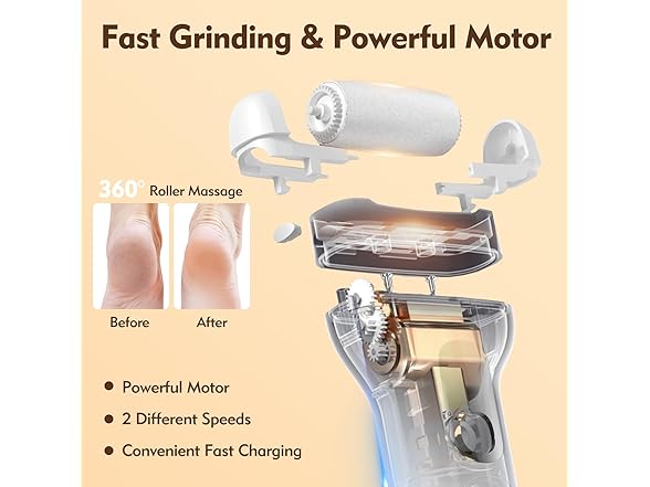 Callus Remover for Feet