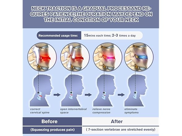 Cervical Neck Traction Device