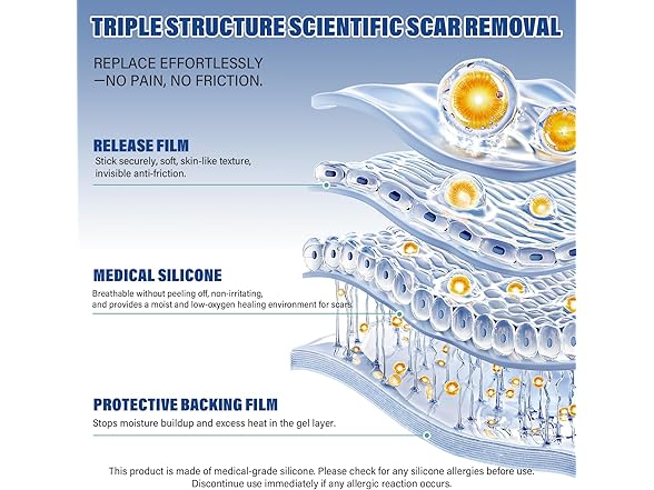 mitreal Silicone Scar Sheets