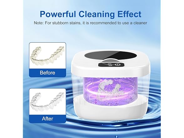 Professional Ultrasonic Retainer Cleaner Retainer