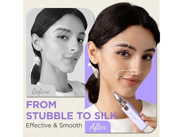 Rechargeable Facial Hair Remover