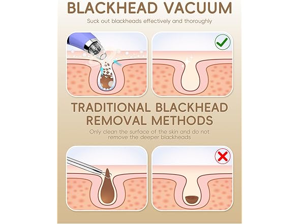 Facial Pore Blackhead Remover Vacuum