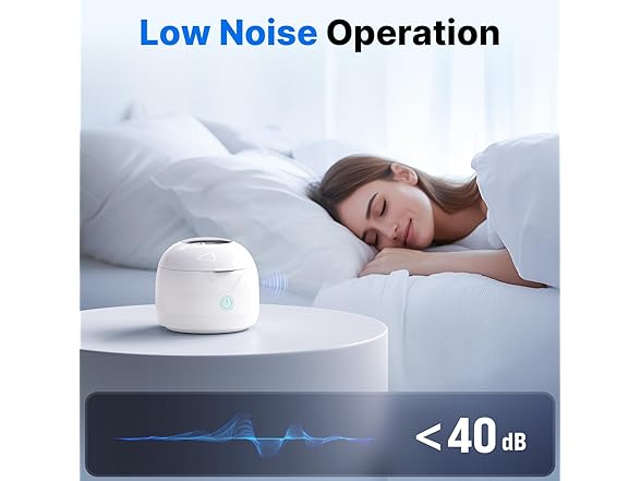 CXRUY Ultrasonic Retainer Cleaner