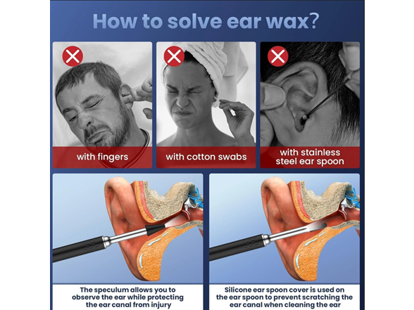 Ear Wax Removal 1080P Camera Tool