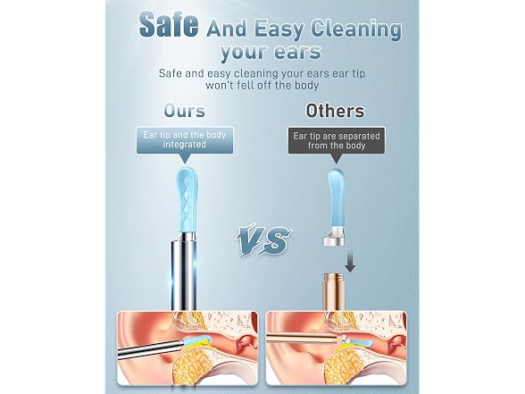 Kolrry Ear Wax Removal Tool
