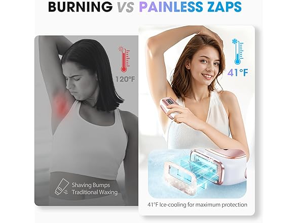 IPL Laser Hair Removal Device