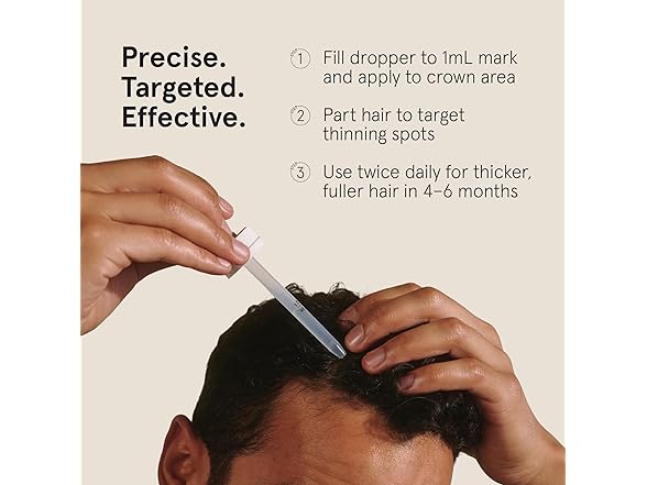 Keeps Extra Strength Minoxidil