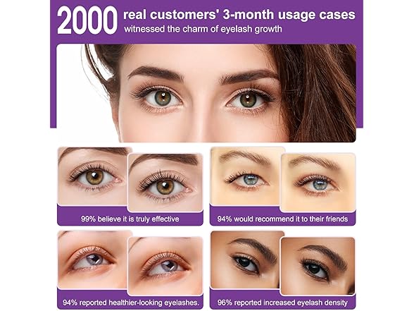 LOTIYI Lash Serum for Eyelash Growth - 6ml