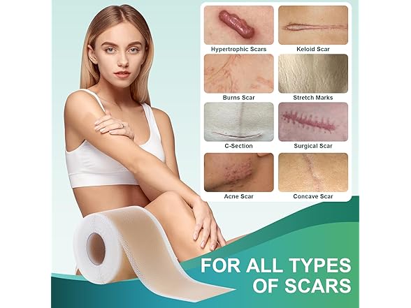 Gowgaw Medical Grade Silicone Scar Sheets