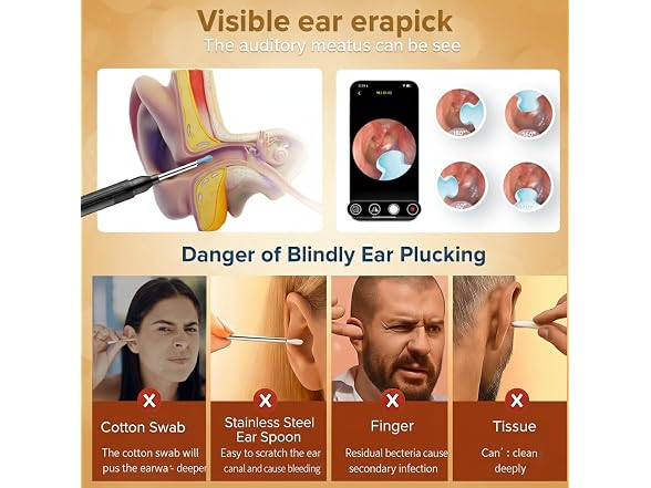 Bekhic Ear Wax Removal Tool Camera 1296P HD Ear