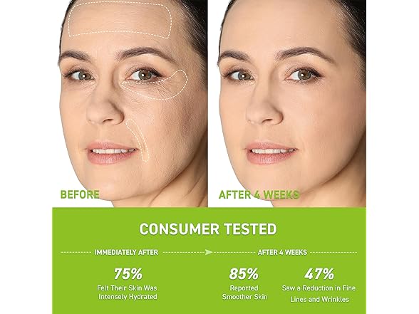 Anti-Wrinkle Retinol Serum for Face