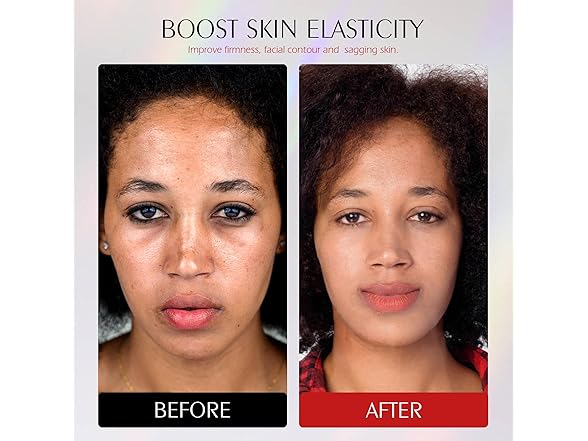 photonstar Red Light Therapy for Face