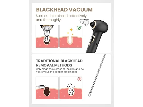 YAGETU Blackhead Remover Vacuum