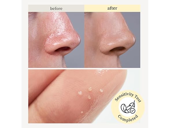 NOONI Korean Cleansing Oil Snow Aqua 0 LHA Toning