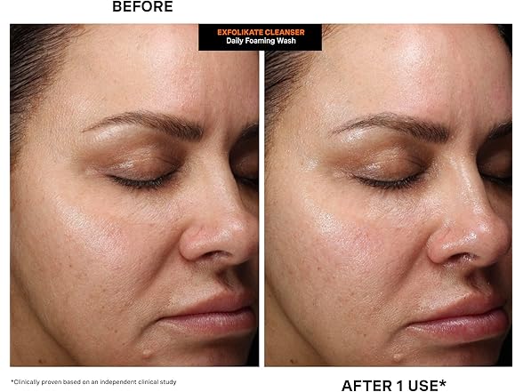 Kate Somerville ExfoliKate Cleanser