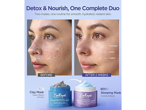 FunRoyal Glow-Boosting Face Masks Skincare Set