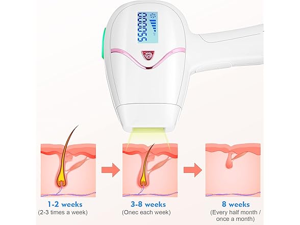 Laser Hair Remover