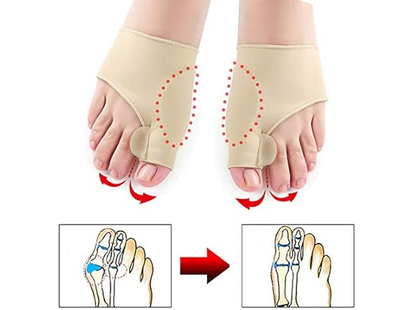 AnHua Valgus Bunion Corrector Orthotics Feet Bone