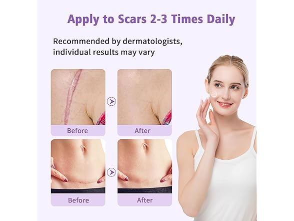 Silicone Scar Gel Scar Cream | 1.7 oz