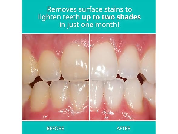 Opalescence Whitening Toothpaste Mint 3 Pack