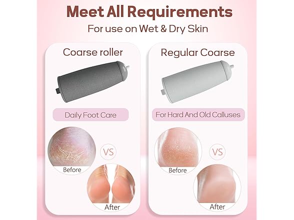 ZABOUL Electric Foot Callus Remover