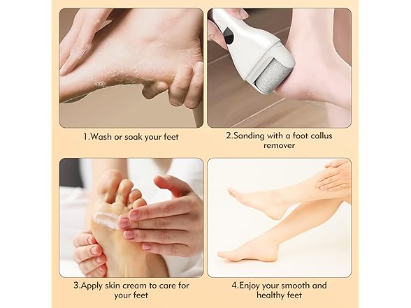 Callus Remover for Feet