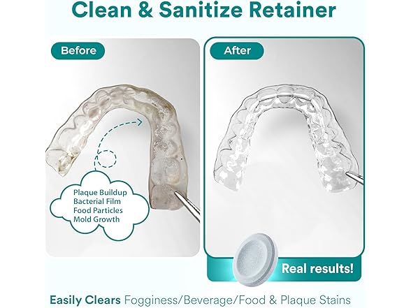 Weiss Naturals Retainer Cleaner Tablets