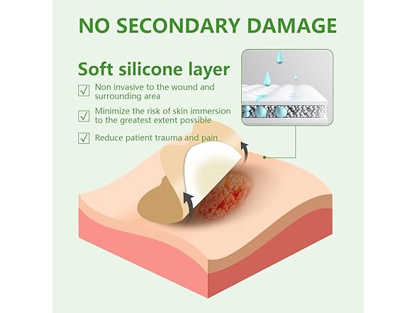 kastormed Sacral Foam Dressing