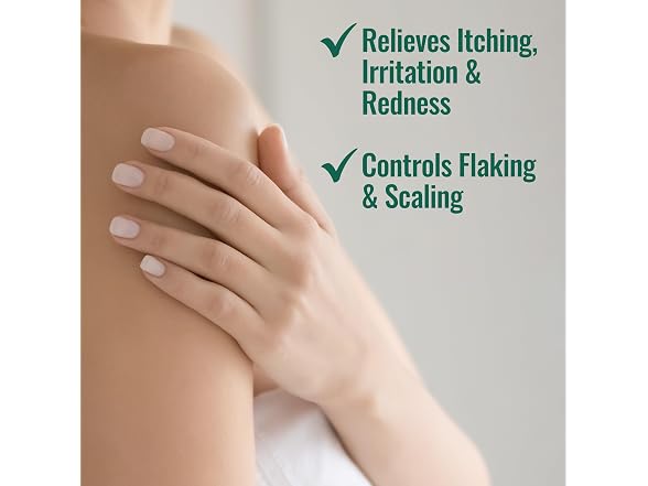 Nizoral Psoriasis Relief Cream 4Oz (2Pk)