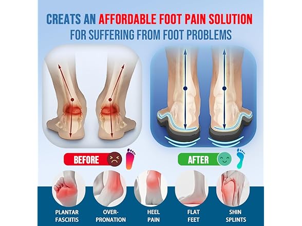 AOBEKOS Plantar Fasciitis Insoles