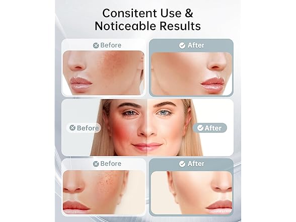 Dopsikn Red Light Therapy