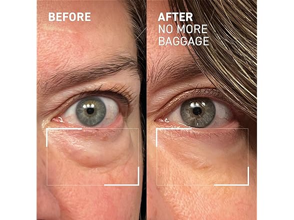 Dr. Brandt Needles No More, No More Baggage - 0.5 oz