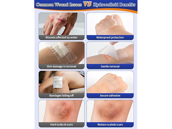 Nidkoud Hydrocolloid Roll for Wound Care