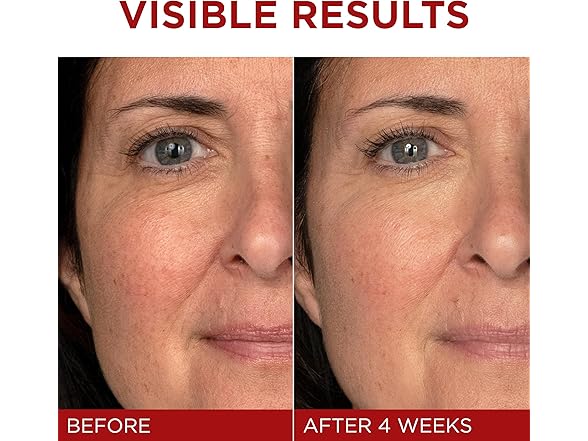 L'Oreal Paris Revitalift Triple Power Anti-Aging Face Moisturizer