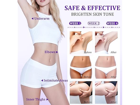 JIANLANPTT Dark Spot Remover