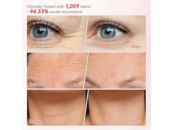 Peunitory Eye Balm Stick