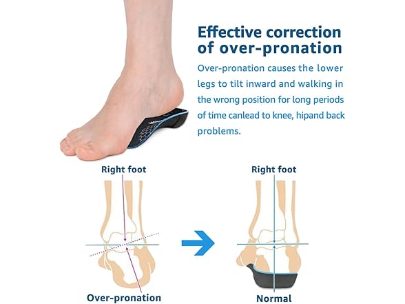 Xshum 3/4 Orthotic Insoles