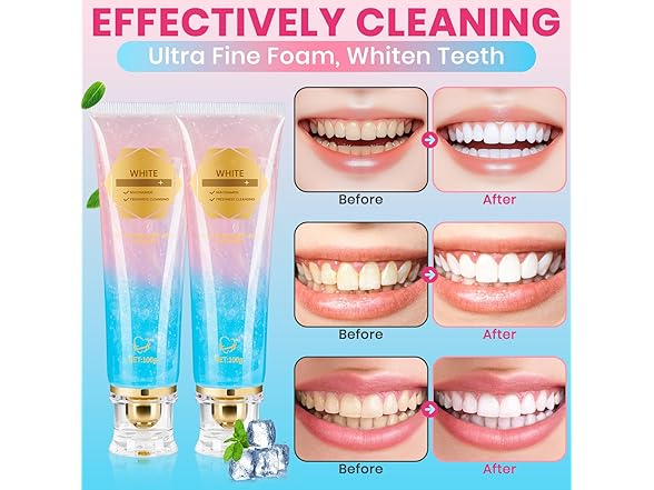 2Pk Niacinamide Whitening Toothpaste