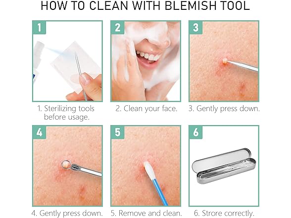 Pinkiou Blackhead Remover Comedone Pimple Popper Tool 