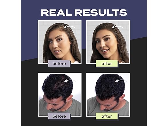 2PK Toppik Hair Building Fibers (Your Choice)
